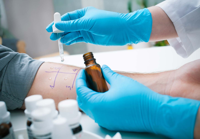 polizza medico allergologo